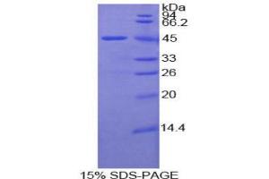 SDS-PAGE analysis of Mouse LAMP2 Protein. (LAMP2 Protein)