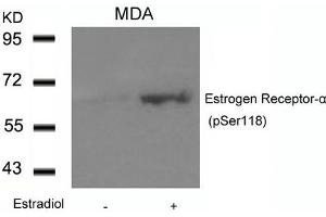 Western blot analysis of extracts from MDA cells untreated or treated with Estradiol using Estrogen Receptor-a(Phospho-Ser118) Antibody. (Estrogen Receptor alpha Antikörper  (pSer118))