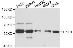Western blot analysis of extracts of various cell lines, using DKC1 antibody. (DKC1 Antikörper  (AA 1-180))