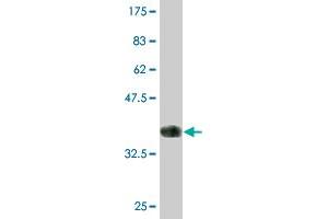Western Blot detection against Immunogen (36. (IRAK2 Antikörper  (AA 111-210))