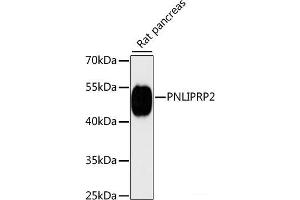 Western blot analysis of extracts of Rat pancreas using PNLIPRP2 Polyclonal Antibody at dilution of 1:3000. (PNLIPRP2 Antikörper)