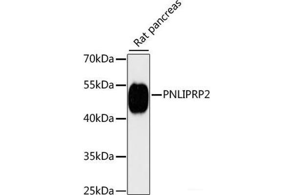 PNLIPRP2 Antikörper