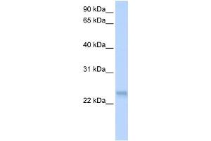 WB Suggested Anti-SFRS3 Antibody Titration: 0. (SRSF3 Antikörper  (N-Term))