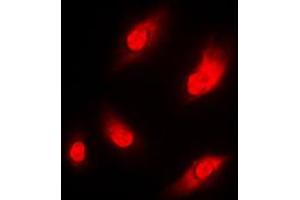 Immunofluorescent analysis of NAA15 staining in THP1 cells. (NAA15 Antikörper  (Center))