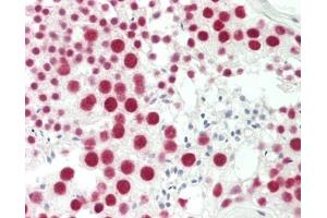 Immunohistochemistry (Paraffin-embedded Sections) (IHC (p)) image for anti-TAF15 RNA Polymerase II, TATA Box Binding Protein (TBP)-Associated Factor, 68kDa (TAF15) (AA 175-225) antibody (ABIN2628947)