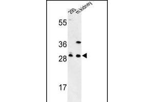 Western blot analysis of GCLM Antibody (C-term) (ABIN653046 and ABIN2842657) in 293 cell line and mouse kidney tissue lysates (35 μg/lane). (GCLM Antikörper  (C-Term))