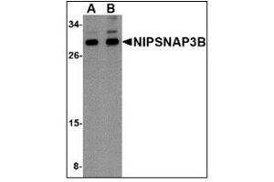 Western blot analysis of NIPSNAP3B in mouse brain tissue lysate with NIPSNAP3B antibody at (A) 1 and (B) 2 µg/ml (NIPSNAP3B Antikörper  (Center))