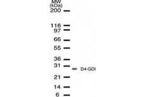 Image no. 1 for anti-rho GDP Dissociation Inhibitor (GDI) beta (ARHGDIB) (AA 125-137) antibody (ABIN207933) (ARHGDIB Antikörper  (AA 125-137))