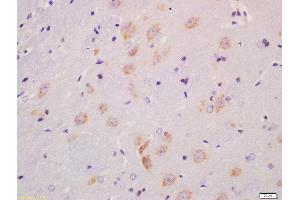 Formalin-fixed and paraffin embedded rat brain labeled with Anti-MST4 + MST3 + STK25 (Thr178 + Thr190 + Thr174) Polyclonal Antibody, Unconjugated  at 1:200 followed by conjugation to the secondary antibody and DAB staining