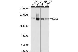 Western blot analysis of extracts of various cell lines, using ROR1 antibody (ABIN1682562, ABIN3017682, ABIN3017683 and ABIN6220210) at 1:1000 dilution. (ROR1 Antikörper  (AA 30-200))