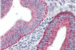 Human Uterus (formalin-fixed, paraffin-embedded) stained with HAVCR1 antibody ABIN337189 at 5 ug/ml followed by biotinylated goat anti-rabbit IgG secondary antibody ABIN481713, alkaline phosphatase-streptavidin and chromogen. (HAVCR1 Antikörper  (Internal Region))