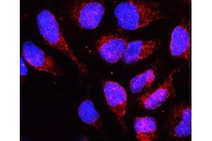 IF analysis of LBR using anti-LBR antibody (ABIN6719340). (Lamin B Receptor Antikörper  (AA 102-209))