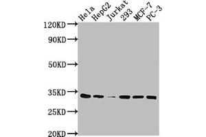 Western Blot Positive WB detected in: Hela whole cell lysate, HepG2 whole cell lysate, Jurkat whole cell lysate, 293 whole cell lysate, MCF-7 whole cell lysate, PC-3 whole cell lysate All lanes: CDK4 antibody at 1:2000 Secondary Goat polyclonal to rabbit IgG at 1/50000 dilution Predicted band size: 34, 21 kDa Observed band size: 34 kDa (Rekombinanter CDK4 Antikörper)