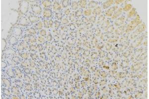 ABIN6273618 at 1/100 staining Human gastric tissue by IHC-P. (CYB5B Antikörper  (Internal Region))