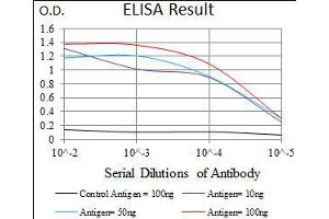 Black line: Control Antigen (100 ng), Purple line: Antigen(10 ng), Blue line: Antigen (50 ng), Red line: Antigen (100 ng), (Calmegin Antikörper  (AA 249-405))