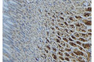 ABIN6277302 at 1/100 staining Human gastric tissue by IHC-P. (SDHA Antikörper  (Internal Region))