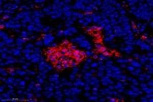 Immunofluorescent analysis of paraformaldehyde-fixed human ovay cancer using FLJ22167 (ABIN7073961) at dilution of 1: 1400 (FLJ22167 Antikörper)