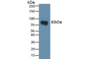 Western blot analysis of recombinant Rat CA2. (CA2 Antikörper)