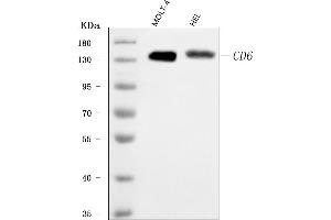 Western blot analysis of T12/CD6 using anti-T12/CD6 antibody (ABIN7599974).