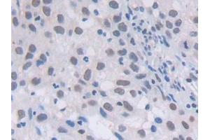 Immunohistochemistry (IHC) image for anti-phospholipase C, gamma 1 (PLCG1) (AA 1091-1290) antibody (ABIN7431485)