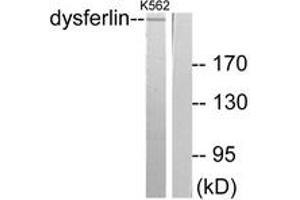 Western blot analysis of extracts from K562 cells, using Dysferlin Antibody.