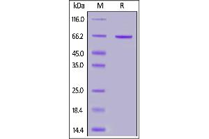 SDS-PAGE (SDS) image for Syndecan 1 (SDC1) (AA 23-254) (Active) protein (Fc Tag) (ABIN7013558)