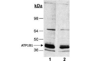 Detection of ATP1B1 in rat kidney homogenates (20 ug) using ATP1B1 monoclonal antibody, clone 464. (ATP1B1 Antikörper)