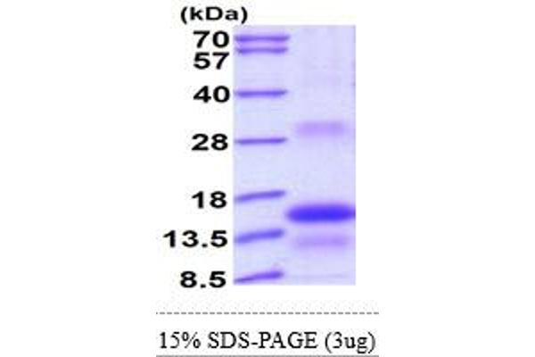 TSHB Protein (AA 21-138) (His tag)