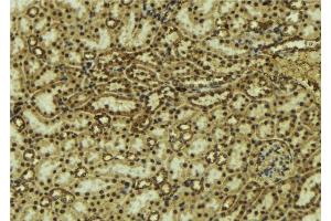 ABIN6277119 at 1/100 staining Mouse kidney tissue by IHC-P. (p63 Antikörper)