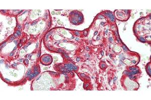 Immunohistochemistry of paraffin-embedded Placenta tissue using CLTC Polyclonal Antibody at dilution of 1:60. (Clathrin Heavy Chain (CLTC) Antikörper)