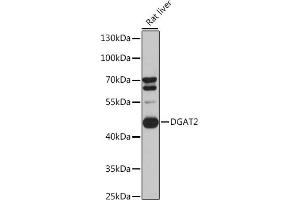 Western blot analysis of extracts of Rat liver cells, using DG antibody (ABIN6130268, ABIN6139559, ABIN6139561 and ABIN6218054) at 1:3000 dilution. (DGAT2 Antikörper  (AA 113-388))