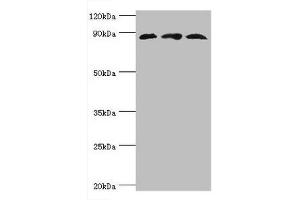 Western blot All lanes: Cullin-1 antibody at 6 μg/mL Lane 1: PC-3 whole cell lysate Lane 2: K562 whole cell lysate Lane 3: Hela whole cell lysate Secondary Goat polyclonal to rabbit IgG at 1/10000 dilution Predicted band size: 90 kDa Observed band size: 90 kDa (Cullin 1 Antikörper  (AA 500-776))