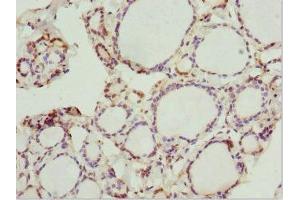 Immunohistochemistry of paraffin-embedded human thyroid tissue using ABIN7162928 at dilution of 1:100 (Peripherin Antikörper  (AA 1-260))