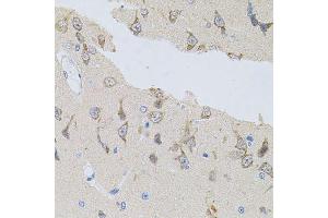 Immunohistochemistry of paraffin-embedded rat brain using NAPA antibody. (NAPA Antikörper)