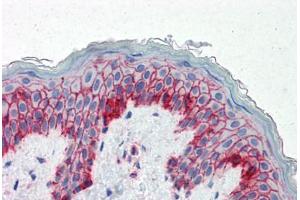 Human Skin (formalin-fixed, paraffin-embedded) stained with B2M antibody ABIN334257 at 5 ug/ml followed by biotinylated anti-mouse IgG secondary antibody ABIN481714, alkaline phosphatase-streptavidin and chromogen. (beta-2 Microglobulin Antikörper)