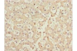 Immunohistochemistry of paraffin-embedded human liver tissue using ABIN7165661 at dilution of 1:100 (IWS1 Antikörper  (AA 570-819))