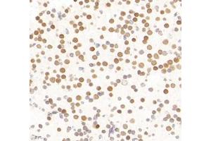 Immunohistochemistry of paraffin embedded mouse neonatal mouse',s brain using LDOCL (ABIN7075411) at dilution of 1:1400 (400x lens) (Retrotransposon Gag-Like Protein 6 (RTL6) Antikörper)