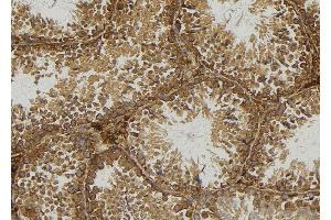 ABIN6277160 at 1/100 staining Mouse testis tissue by IHC-P. (Moesin Antikörper  (C-Term))