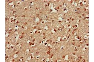 Immunohistochemistry of paraffin-embedded human brain tissue using ABIN7164960 at dilution of 1:100 (PSMA5 Antikörper  (AA 124-180))