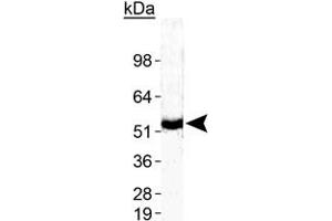 Western blot analysis of ZMPSTE24 in human testis with ZMPSTE24 polyclonal antibody .