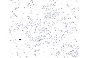 Immunocytochemistry (ICC) image for anti-Zinc Finger CCCH-Type Containing 4 (ZC3H4) (AA 1050-1100) antibody (ABIN7795758)