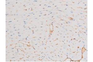 ABIN6267605 at 1/200 staining Mouse heart tissue sections by IHC-P.