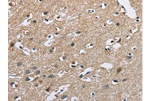 The image on the left is immunohistochemistry of paraffin-embedded Human brain tissue using ABIN7128713(CAB39L Antibody) at dilution 1/40, on the right is treated with fusion protein. (CAB39L Antikörper)