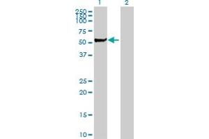 Western Blot analysis of STK3 expression in transfected 293T cell line by STK3 MaxPab polyclonal antibody. (STK3 Antikörper  (AA 1-491))