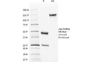 SDS-PAGE Analysis of Purified Calnexin Mouse Monoclonal Antibody ABIN6383807. (Calnexin Antikörper  (Lumenal Region))