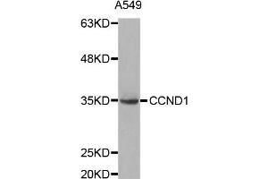 Western blot analysis of extracts of A549 cell lines, using CCND1 antibody. (Cyclin D1 Antikörper)