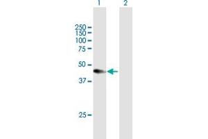 Western Blot analysis of CXADR expression in transfected 293T cell line by CXADR MaxPab polyclonal antibody. (Coxsackie Adenovirus Receptor Antikörper  (AA 1-365))