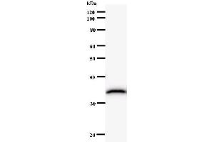 Western Blotting (WB) image for anti-NFS1, Cysteine Desulfurase (NFS1) antibody (ABIN933137) (NFS1 Antikörper)
