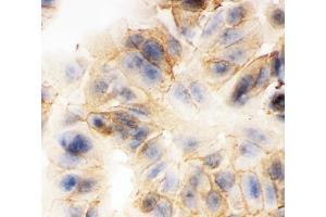 ICC analysis of gamma Catenin using anti-gamma Catenin antibody (ABIN3043864). (JUP Antikörper  (AA 556-745))