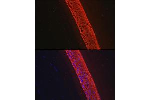 Immunofluorescence (IF) image for anti-Keratin 12 (KRT12) antibody (ABIN7268087)